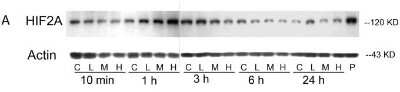 Western Blot: HIF-2 alpha/EPAS1 Antibody (ep190b) [NB100-132]