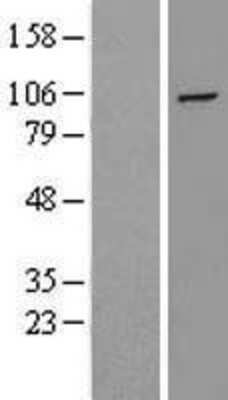 Western Blot: HIF-2 alpha/EPAS1 Overexpression Lysate [NBL1-10286]