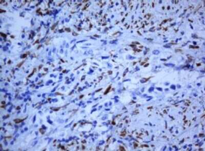 Immunohistochemistry: HIF-3 alpha Antibody (OTI2D2) [NBP2-45735]