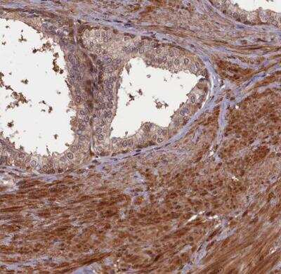 Immunohistochemistry-Paraffin: HIF-3 alpha Antibody [NBP1-89977]