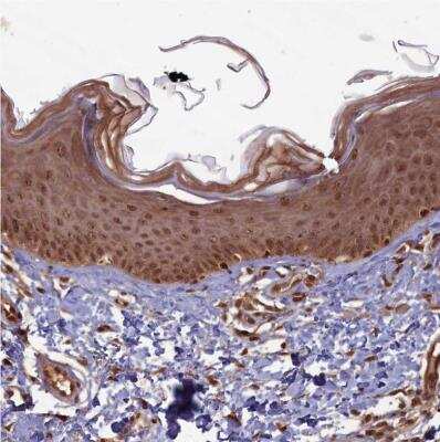 Immunohistochemistry-Paraffin: HIF-3 alpha Antibody [NBP1-89977]