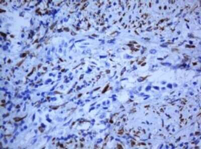 Immunohistochemistry: HIF-3 alpha Antibody (OTI2D2) - Azide and BSA Free [NBP2-72136]