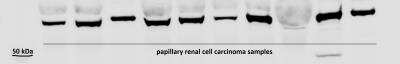 Western Blot: HIF-3 alpha Antibody [NB100-2529]
