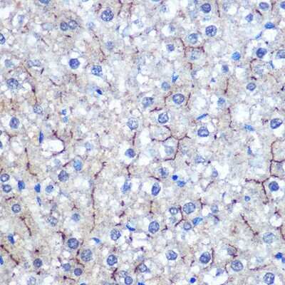 Immunohistochemistry-Paraffin: HIG2 Antibody - Azide and BSA Free [NBP3-03847]