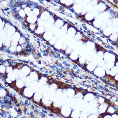 Immunohistochemistry-Paraffin: HIG2 Antibody - Azide and BSA Free [NBP3-03847]