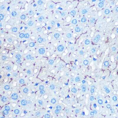 Immunohistochemistry-Paraffin: HIG2 Antibody - Azide and BSA Free [NBP3-03847]