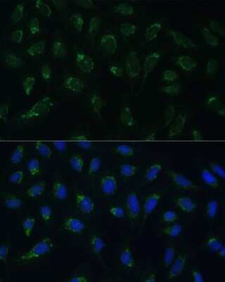 Immunocytochemistry/ Immunofluorescence: HIGD1A Antibody - Azide and BSA Free [NBP3-03930]