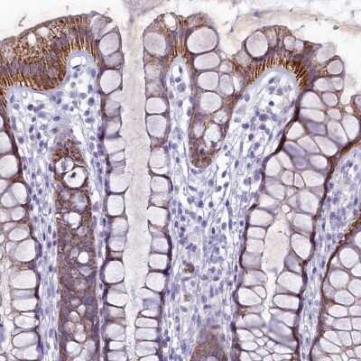 Immunohistochemistry-Paraffin: HIGD1A Antibody [NBP1-84153]