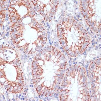Immunohistochemistry-Paraffin: HIGD1A Antibody - Azide and BSA Free [NBP3-03930]