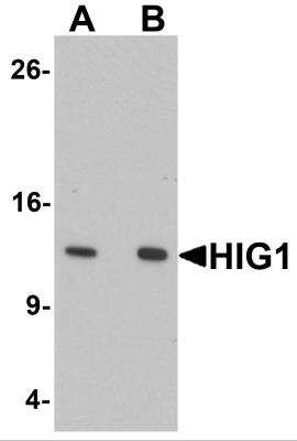 Western Blot: HIGD1A AntibodyBSA Free [NBP2-81721]