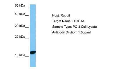 Western Blot: HIGD1A Antibody [NBP2-83044]