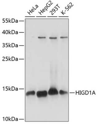 Western Blot: HIGD1A AntibodyAzide and BSA Free [NBP3-03930]