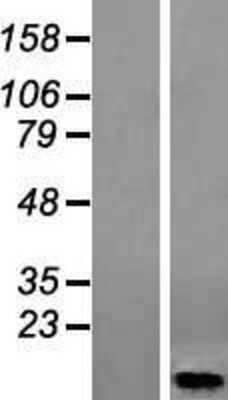 Western Blot: HIGD1A Overexpression Lysate [NBL1-11542]