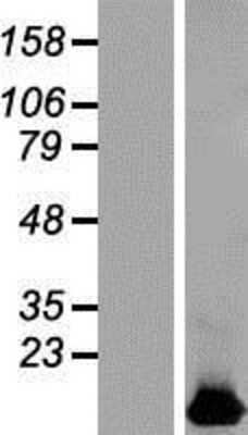 Western Blot: HIGD1B Overexpression Lysate [NBL1-11543]