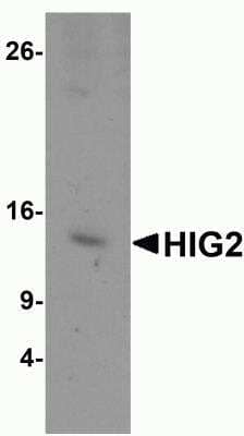 Western Blot: HIGD2A AntibodyBSA Free [NBP2-81722]