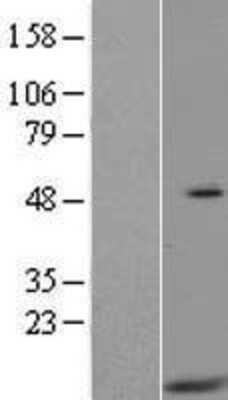 Western Blot: HIGD2A Overexpression Lysate [NBL1-11544]