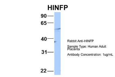 Western Blot: HINFP Antibody [NBP2-85045]