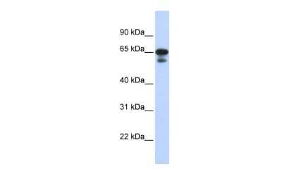 Western Blot: HINFP Antibody [NBP2-85046]