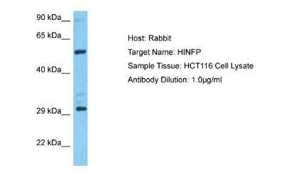 Western Blot: HINFP Antibody [NBP2-85047]