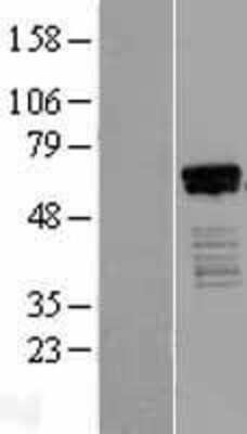 Western Blot: HINFP Overexpression Lysate [NBL1-13119]