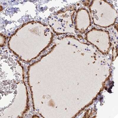 Immunohistochemistry-Paraffin: HINT1 Antibody [NBP1-83257]