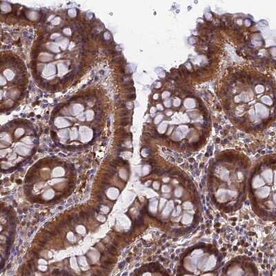 Immunohistochemistry-Paraffin: HINT1 Antibody [NBP1-83257]