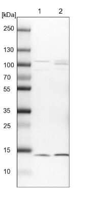 Western Blot: HINT1 Antibody [NBP1-83257]