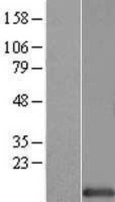 Western Blot: HINT1 Overexpression Lysate [NBL1-11545]