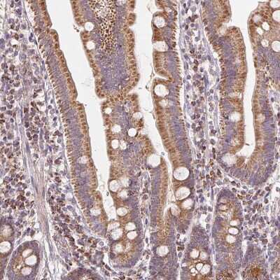 Immunohistochemistry-Paraffin: HINT2 Antibody [NBP2-56156]