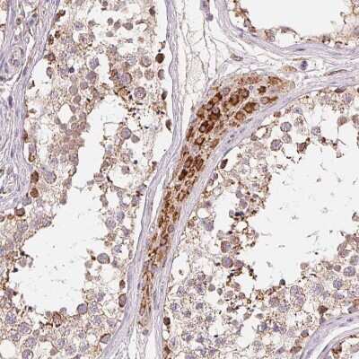 Immunohistochemistry-Paraffin: HINT2 Antibody [NBP2-56156]