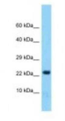 Western Blot: HINT2 Antibody [NBP1-98460]