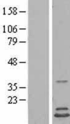 Western Blot: HINT2 Overexpression Lysate [NBL1-11546]