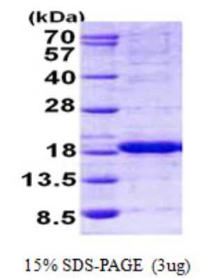 SDS-PAGE: Recombinant Human HINT2 His Protein [NBP2-23124]