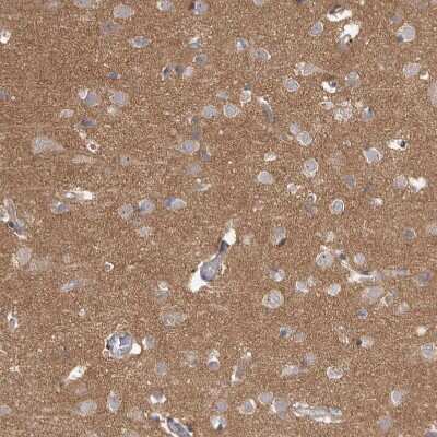 Immunohistochemistry-Paraffin: HINT3 Antibody [NBP1-81981]