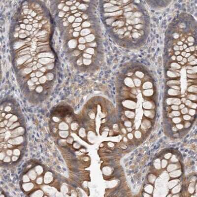 Immunohistochemistry-Paraffin: HINT3 Antibody [NBP1-81981]
