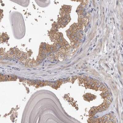 Immunohistochemistry-Paraffin: HINT3 Antibody [NBP1-81981]