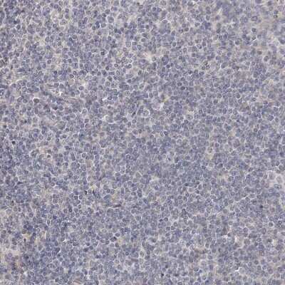 Immunohistochemistry-Paraffin: HINT3 Antibody [NBP1-81981]
