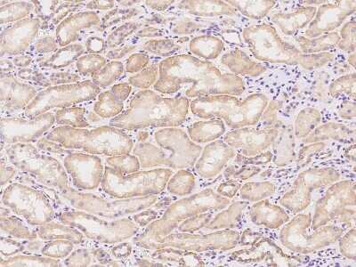 Immunohistochemistry-Paraffin: HINT3 Antibody [NBP2-97827]
