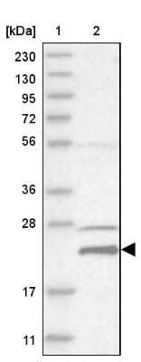 Western Blot: HINT3 Antibody [NBP1-81981]