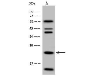 Western Blot: HINT3 Antibody [NBP2-97827]