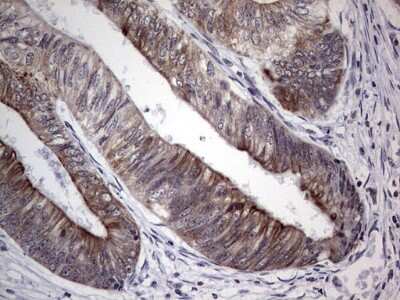 Immunohistochemistry: HIP-55 Antibody (OTI6C9) [NBP2-46428]