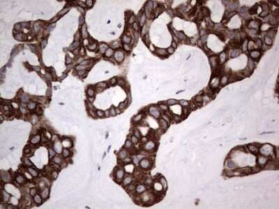 Immunohistochemistry: HIP-55 Antibody (OTI6C9) [NBP2-46428]