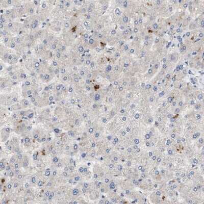 Immunohistochemistry-Paraffin: HIP-55 Antibody [NBP1-91988]
