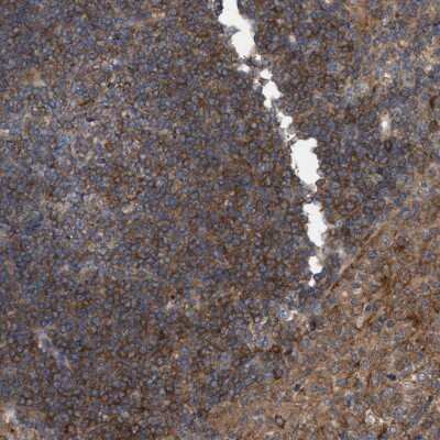 Immunohistochemistry-Paraffin: HIP-55 Antibody [NBP1-91988]