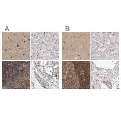 Immunohistochemistry-Paraffin: HIP-55 Antibody [NBP1-91988]