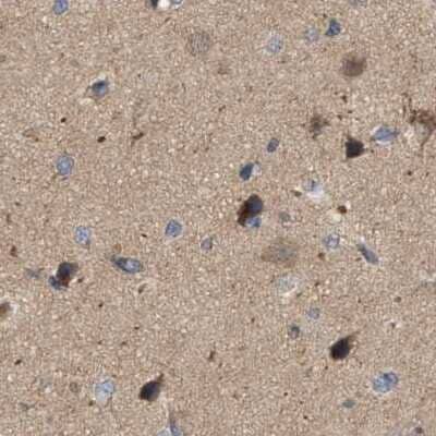 Immunohistochemistry-Paraffin: HIP-55 Antibody [NBP1-91988]