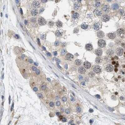 Immunohistochemistry-Paraffin: HIP-55 Antibody [NBP1-91988]