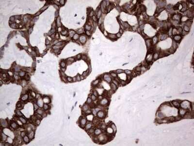 Immunohistochemistry: HIP-55 Antibody (OTI6C9) - Azide and BSA Free [NBP2-71841]