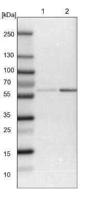 Western Blot: HIP-55 Antibody [NBP1-91988]