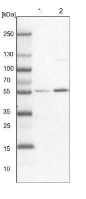Western Blot: HIP-55 Antibody [NBP1-91989]